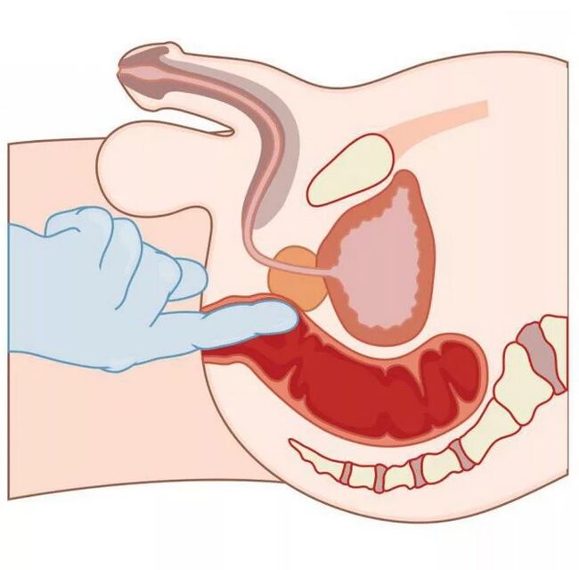 Vīriešu G punkta atrašanās vieta